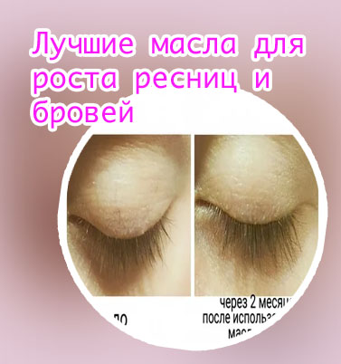 Масло для отращивания ресниц